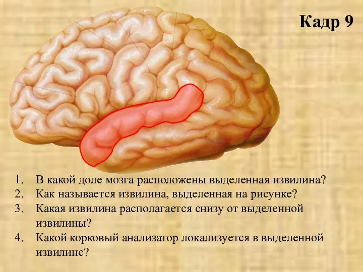 Кадр 9 В какой доле мозга расположены выделенная извилина? Как называется извилина,