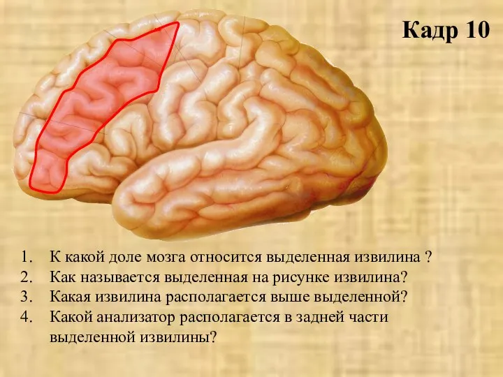 Кадр 10 К какой доле мозга относится выделенная извилина ? Как называется