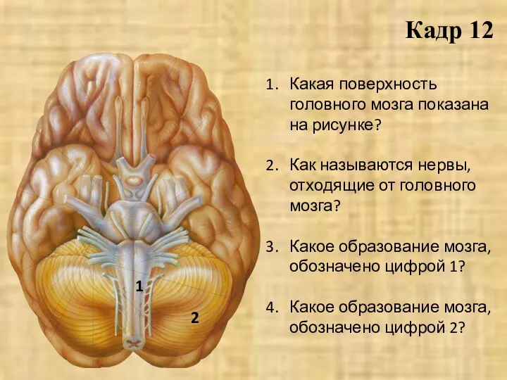 Какая поверхность головного мозга показана на рисунке? Как называются нервы, отходящие от