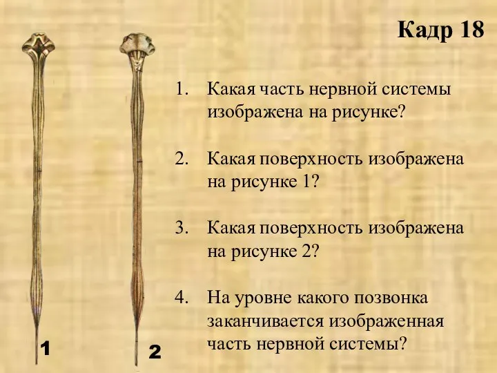 Какая часть нервной системы изображена на рисунке? Какая поверхность изображена на рисунке