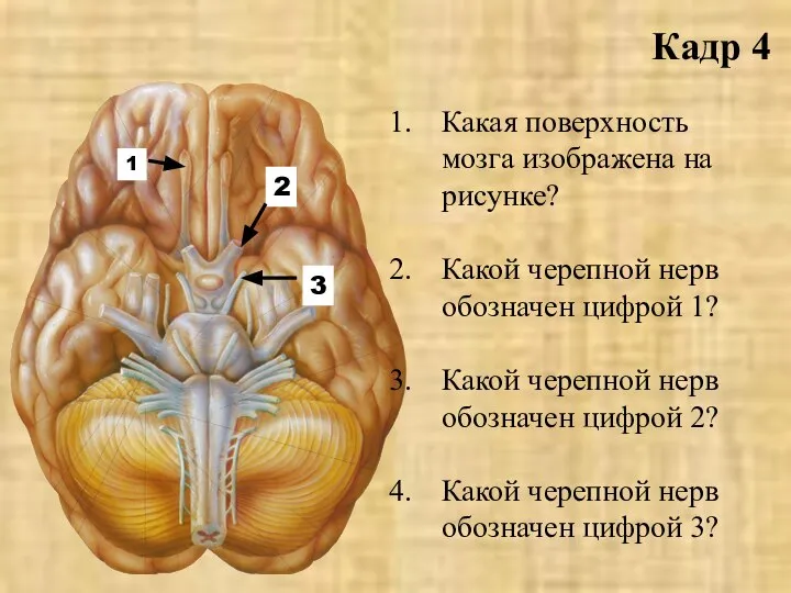 Кадр 4 Какая поверхность мозга изображена на рисунке? Какой черепной нерв обозначен