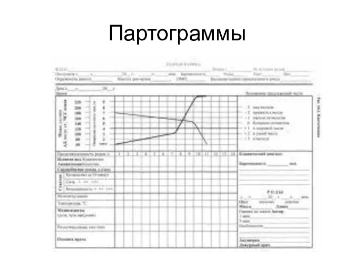 Партограммы