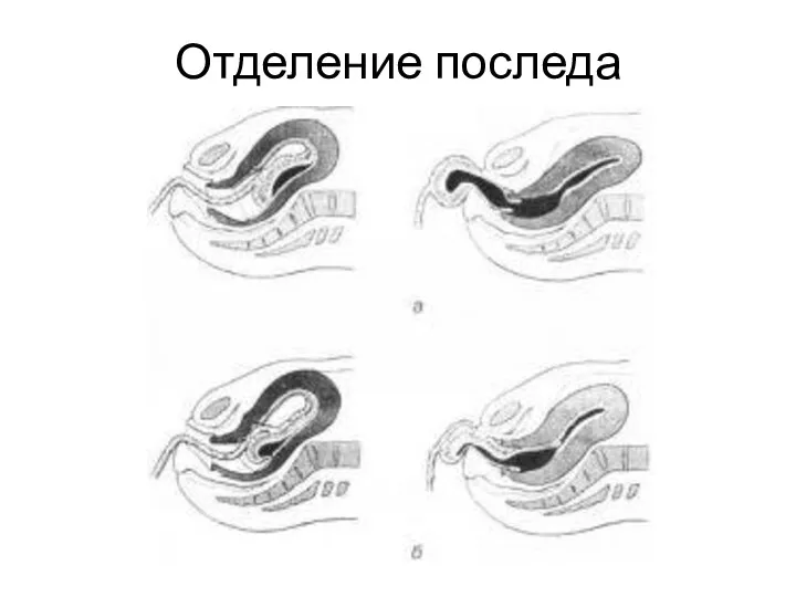 Отделение последа