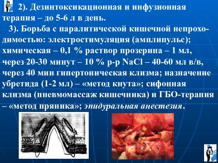 2). Дезинтоксикационная и инфузионная терапия – до 5-6 л в день. 3).