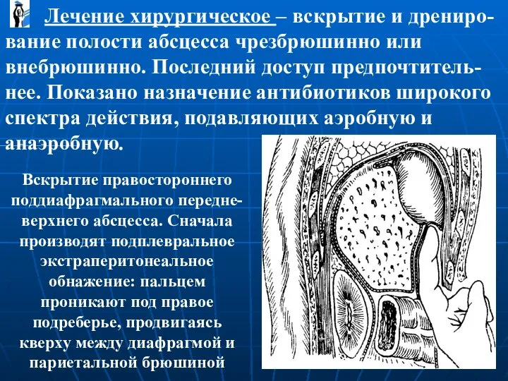 Лечение хирургическое – вскрытие и дрениро-вание полости абсцесса чрезбрюшинно или внебрюшинно. Последний