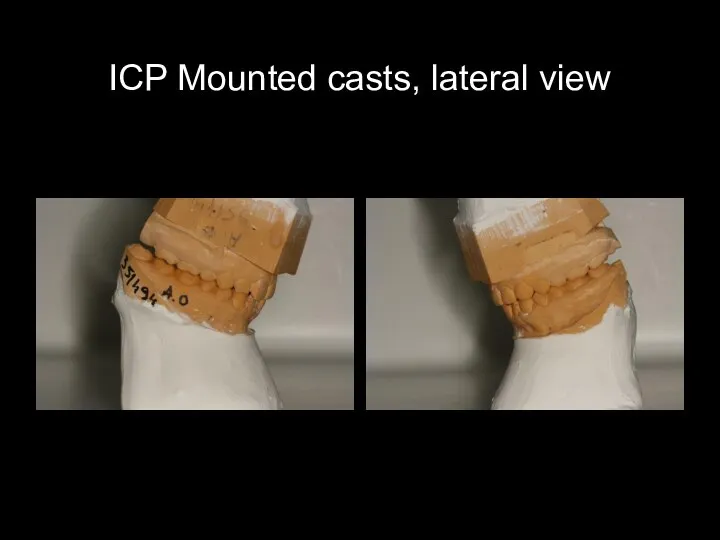 ICP Mounted casts, lateral view