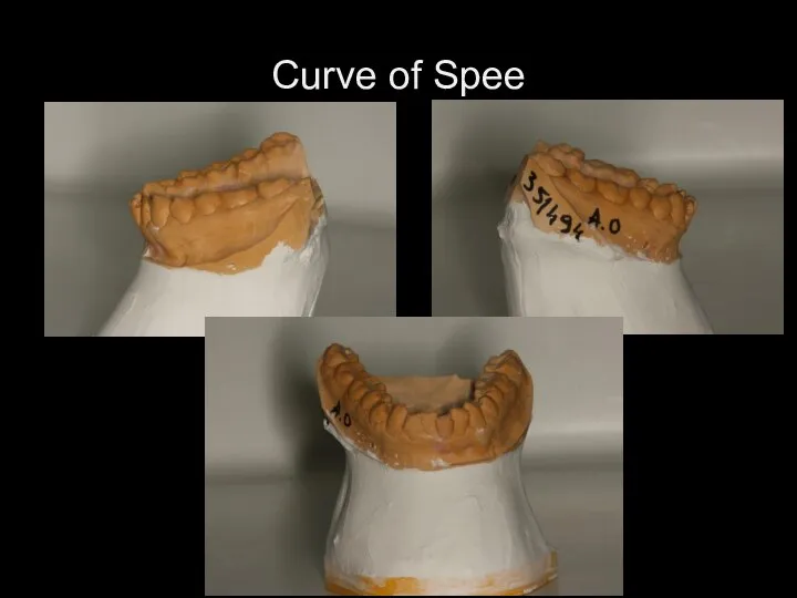 Curve of Spee