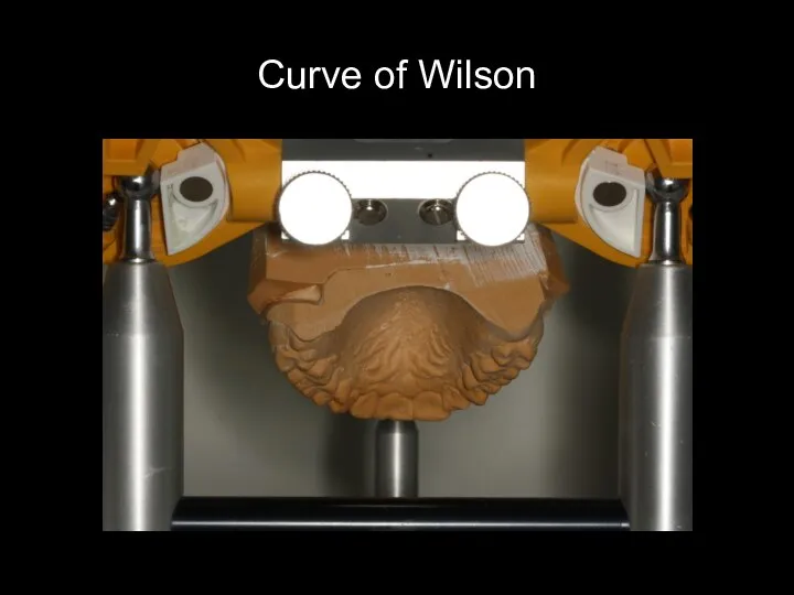 Curve of Wilson