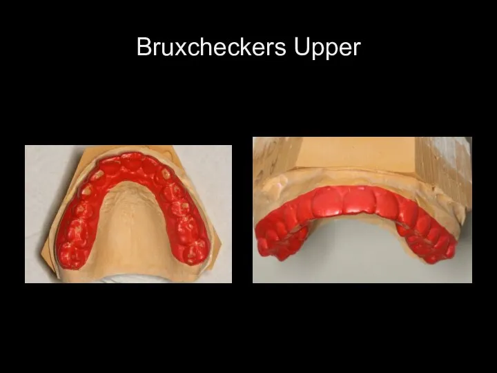 Bruxcheckers Upper