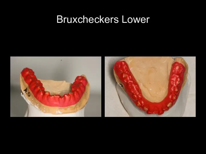 Bruxcheckers Lower