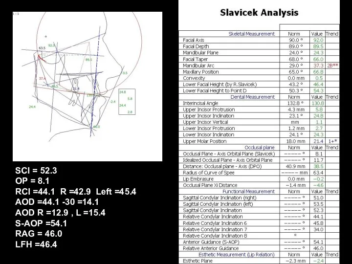 SCI = 52.3 OP = 8.1 RCI =44.1 R =42.9 Left =45.4