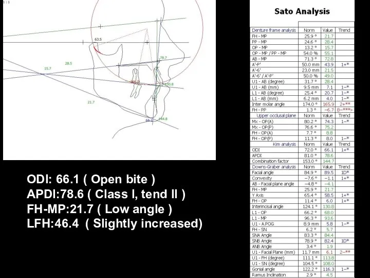 ODI: 66.1 ( Open bite ) APDI:78.6 ( Class I, tend II