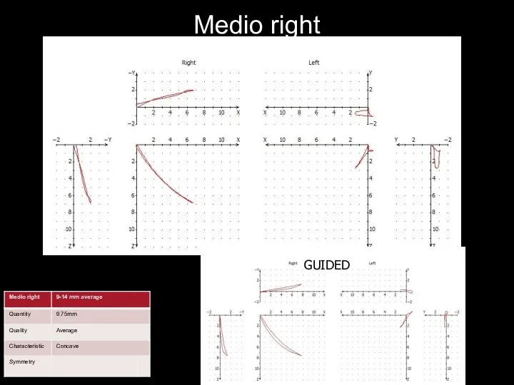 Medio right GUIDED GUIDED GUIDED GUIDED GUIDED GUIDED GUIDED GUIDED GUIDED guided GUIDED