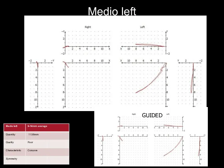 Medio left GUIDED GUIDED GUIDED GUIDED GUIDED GUIDED GUIDED GUIDED GUIDED guided GUIDED