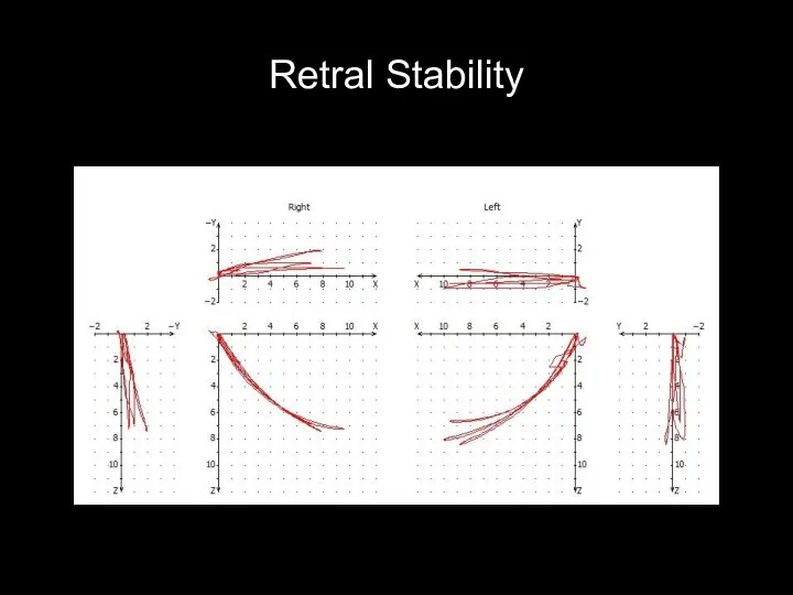 Retral Stability