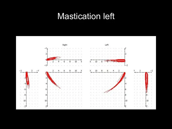 Mastication left