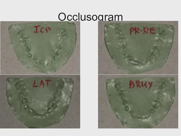 Occlusogram