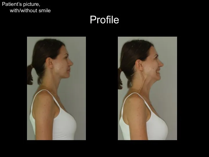 Profile Patient’s picture, with/without smile