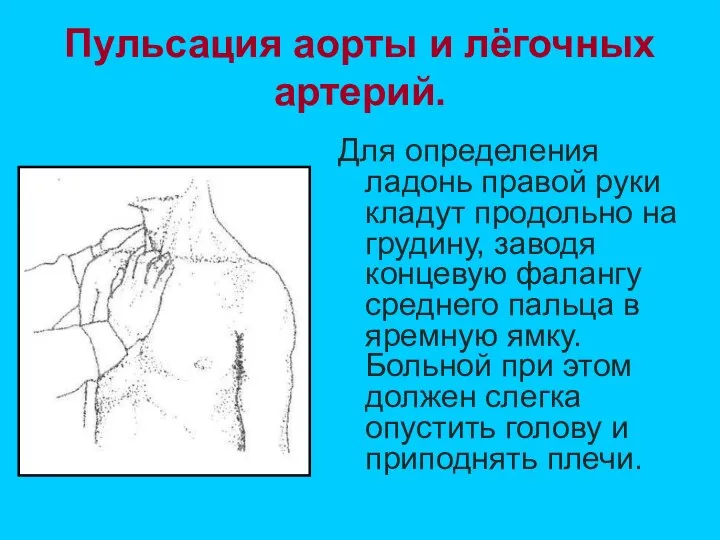 Пульсация аорты и лёгочных артерий. Для определения ладонь правой руки кладут продольно