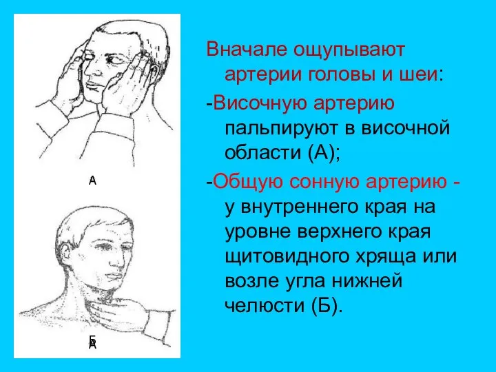 Вначале ощупывают артерии головы и шеи: -Височную артерию пальпируют в височной области