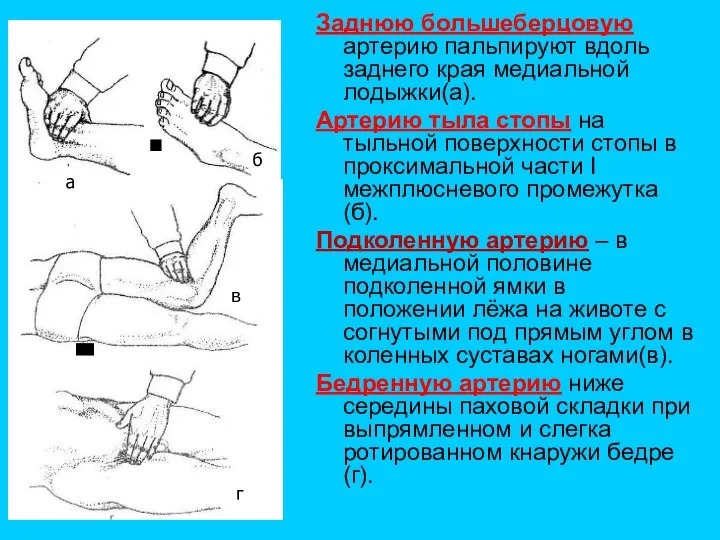 Заднюю большеберцовую артерию пальпируют вдоль заднего края медиальной лодыжки(а). Артерию тыла стопы