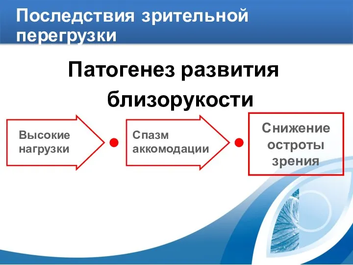 Патогенез развития близорукости Снижение остроты зрения Высокие нагрузки Спазм аккомодации Последствия зрительной перегрузки