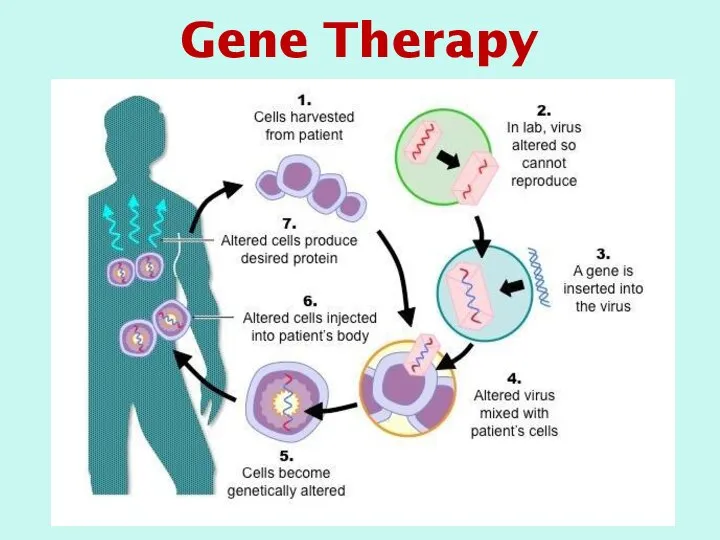 Gene Therapy