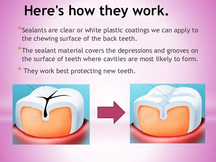 Here's how they work. Sealants are clear or white plastic coatings we