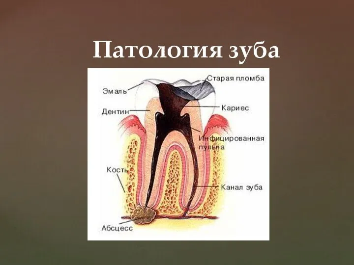Патология зуба
