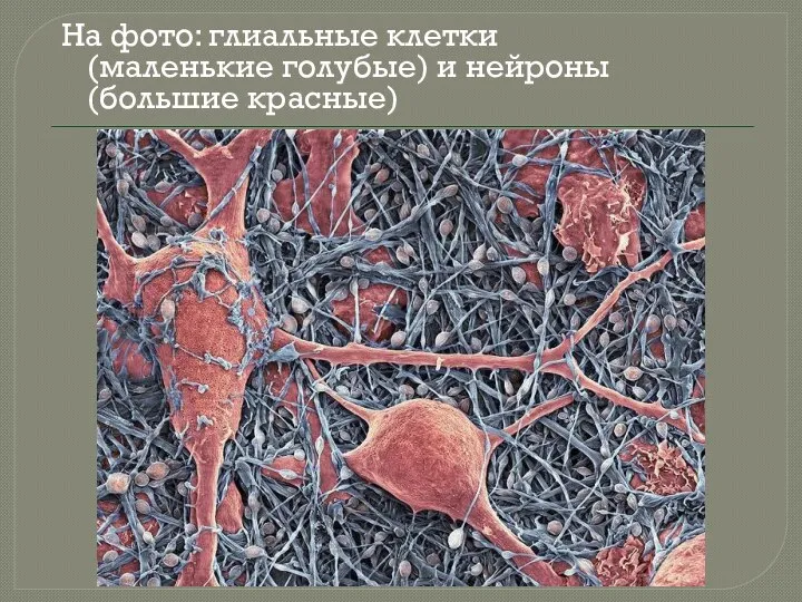 На фото: глиальные клетки (маленькие голубые) и нейроны (большие красные)