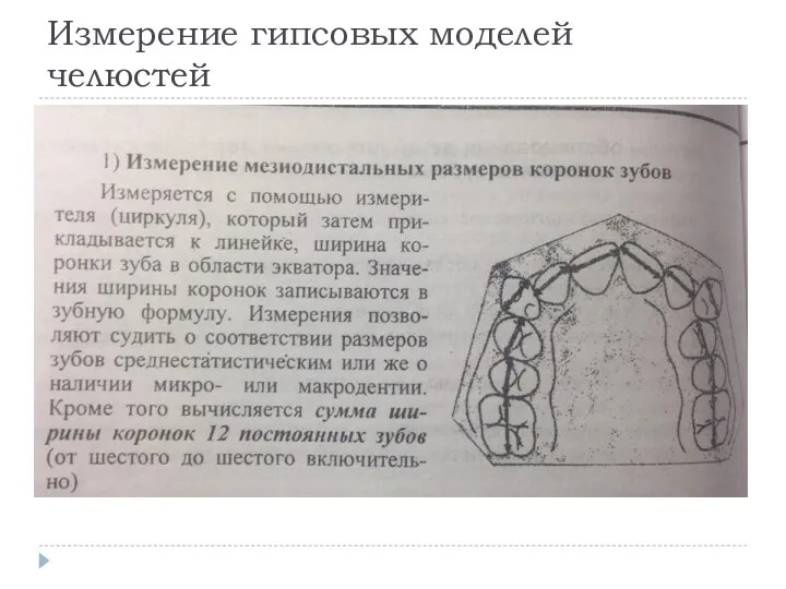 Измерение гипсовых моделей челюстей