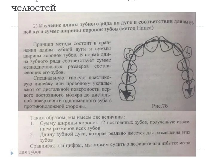 Измерение гипсовых моделей челюстей