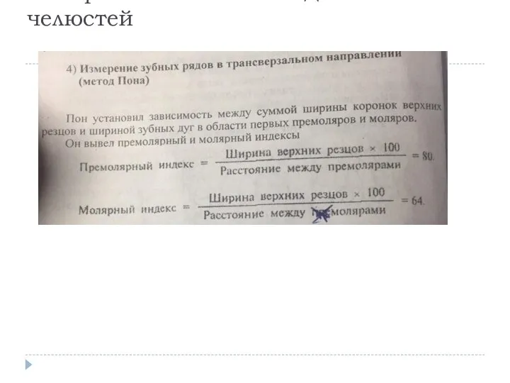 Измерение гипсовых моделей челюстей