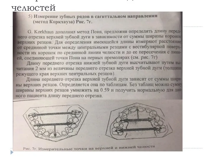 Измерение гипсовых моделей челюстей