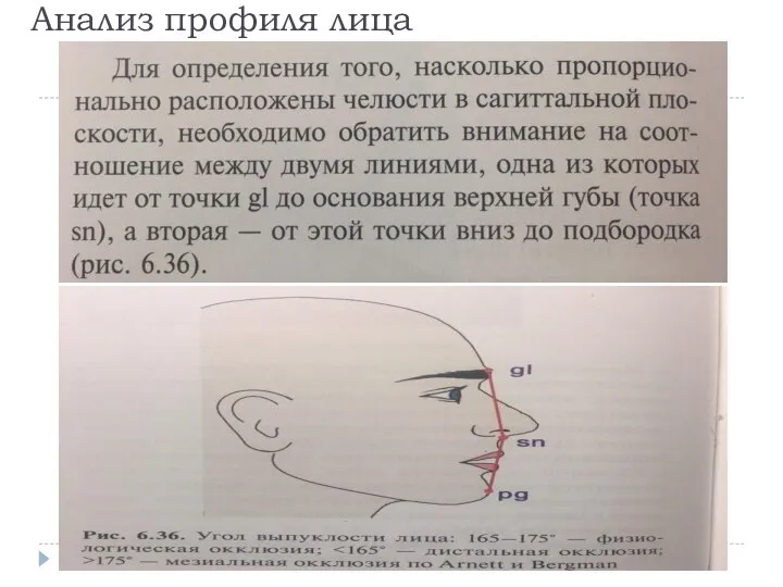 Анализ профиля лица