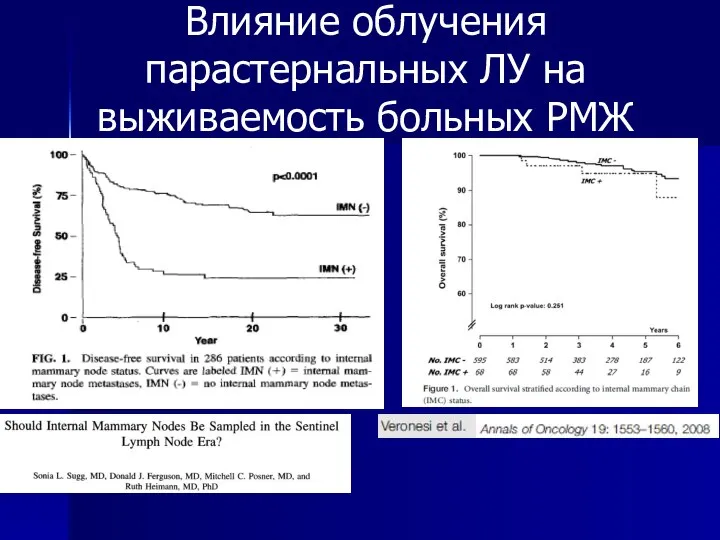 Влияние облучения парастернальных ЛУ на выживаемость больных РМЖ