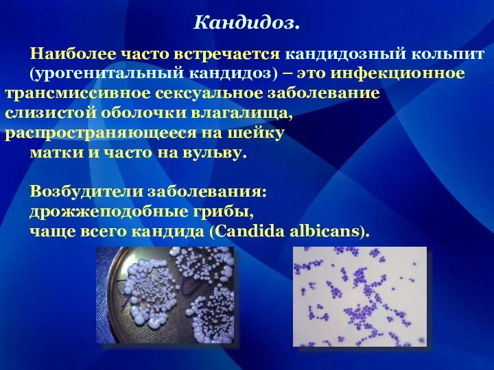 Кандидоз. Наиболее часто встречается кандидозный кольпит (урогенитальный кандидоз) – это инфекционное трансмиссивное