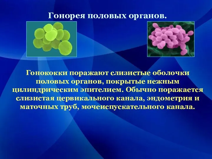 Гонорея половых органов. Гонококки поражают слизистые оболочки половых органов, покрытые нежным цилиндрическим