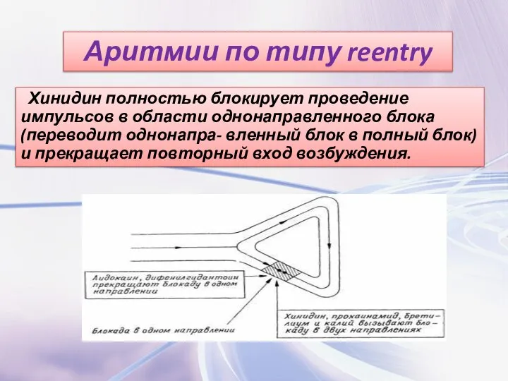 Аритмии по типу reentry Хинидин полностью блокирует проведение импульсов в области однонаправленного