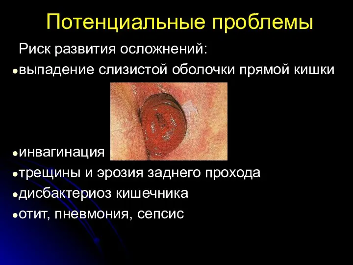 Потенциальные проблемы Риск развития осложнений: выпадение слизистой оболочки прямой кишки инвагинация кишечника