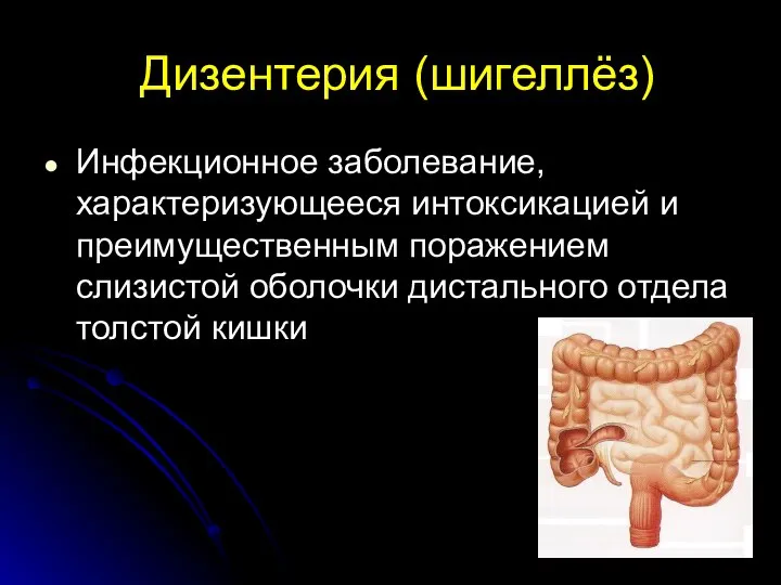 Дизентерия (шигеллёз) Инфекционное заболевание, характеризующееся интоксикацией и преимущественным поражением слизистой оболочки дистального отдела толстой кишки