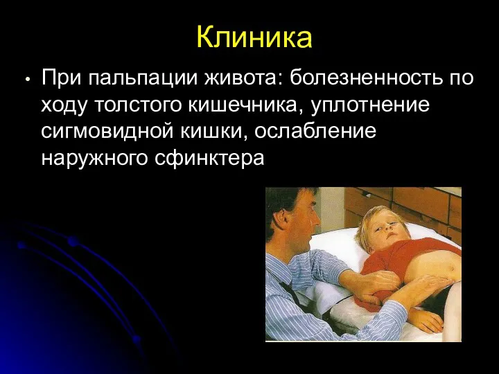 Клиника При пальпации живота: болезненность по ходу толстого кишечника, уплотнение сигмовидной кишки, ослабление наружного сфинктера