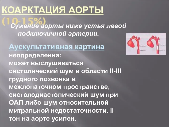 КОАРКТАЦИЯ АОРТЫ (10-15%) Сужение аорты ниже устья левой подключичной артерии. Аускультативная картина