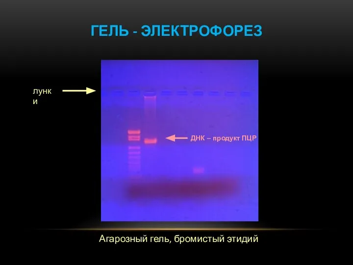 ГЕЛЬ - ЭЛЕКТРОФОРЕЗ Агарозный гель, бромистый этидий ДНК – продукт ПЦР лунки