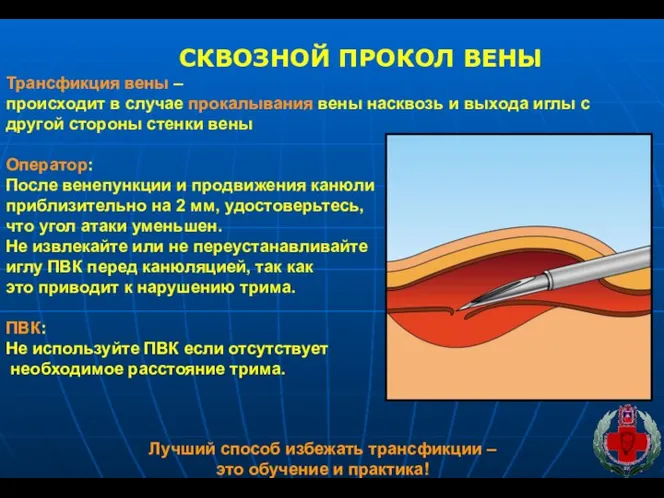 СКВОЗНОЙ ПРОКОЛ ВЕНЫ Трансфикция вены – происходит в случае прокалывания вены насквозь