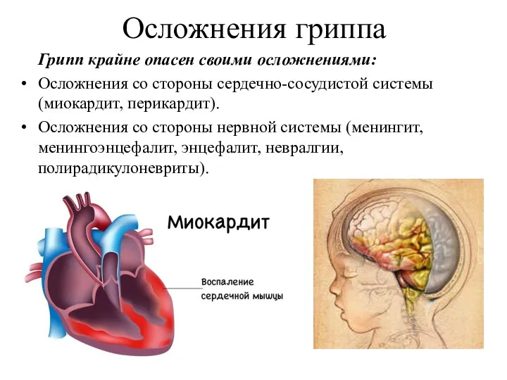 Осложнения гриппа Грипп крайне опасен своими осложнениями: Осложнения со стороны сердечно-сосудистой системы