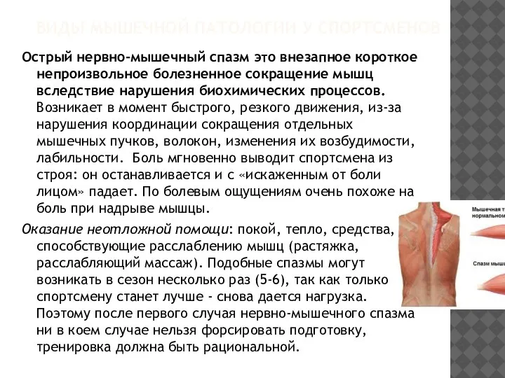 ВИДЫ МЫШЕЧНОЙ ПАТОЛОГИИ У СПОРТСМЕНОВ Острый нервно-мышечный спазм это внезапное короткое непроизвольное