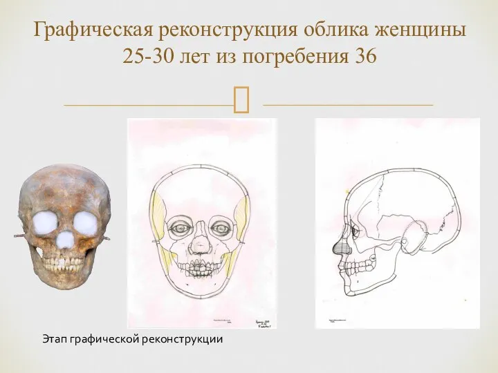 Графическая реконструкция облика женщины 25-30 лет из погребения 36 Этап графической реконструкции