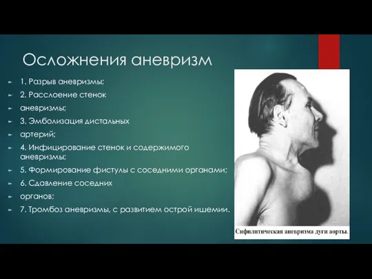 Осложнения аневризм 1. Разрыв аневризмы; 2. Расслоение стенок аневризмы; 3. Эмболизация дистальных