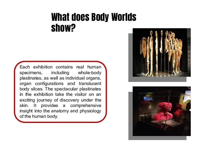 What does Body Worlds show? Each exhibition contains real human specimens, including